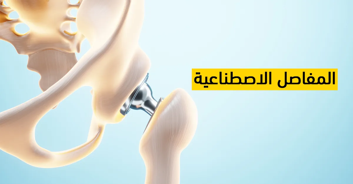 المفاصل الاصطناعية